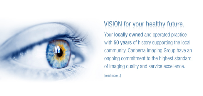 Vision