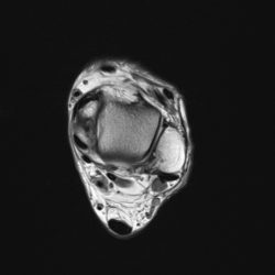 scan