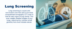 National Lung Cancer Screening